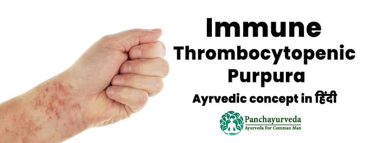 ayurvedic treatment for itp