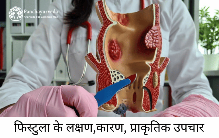 भगन्दर क्या है ?